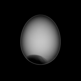 Radiograph of an egg